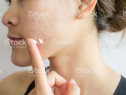 Quisque sed dui consequat nunc tristique interdum