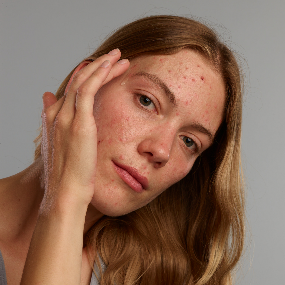 Acnefekt Cleansing Set