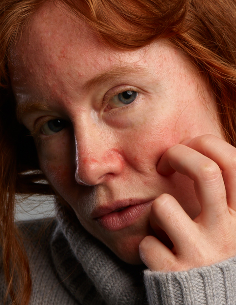 Rosacear Cream Cleansing Set Rosacear Cream Cleansing Set