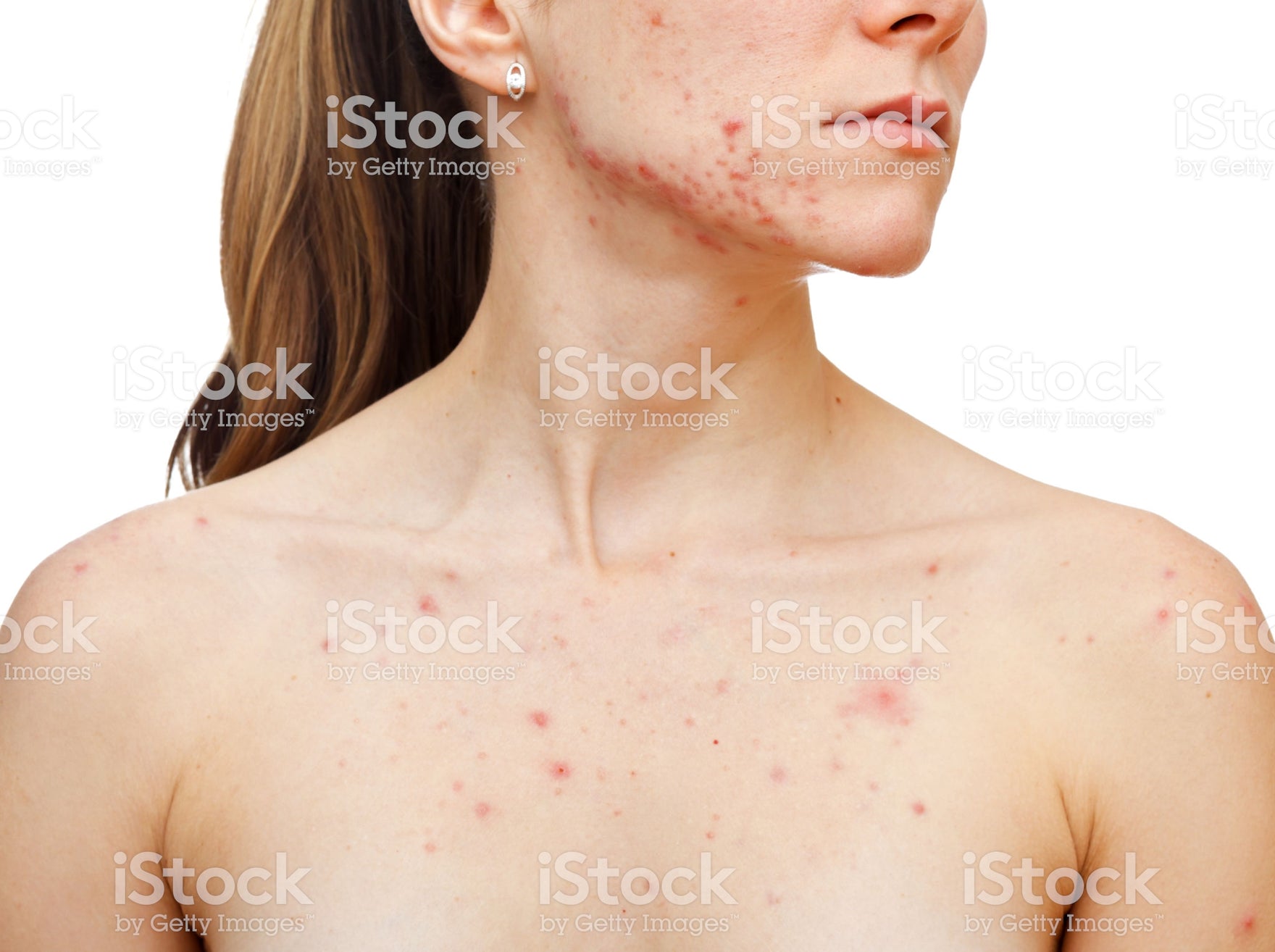 Integer ut elit sed justo sollicitudin bibendum ultricies in orci