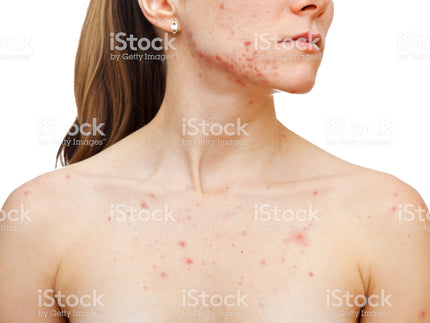 Integer ut elit sed justo sollicitudin bibendum ultricies in orci