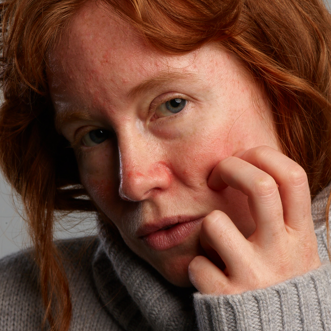 Rosacear Cream Cleansing Set