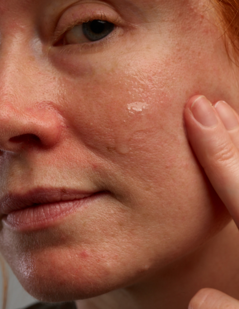 Rosacear Gel Moisturizing Set